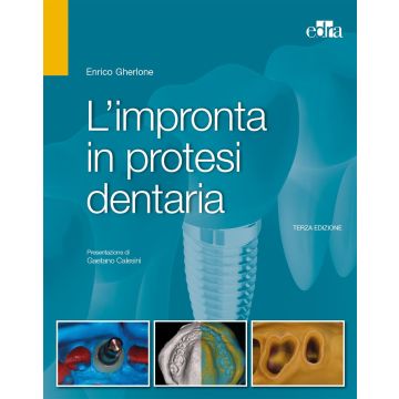 L'Impronta in Protesi dentaria 3/ed. 