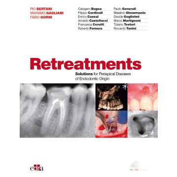 Ritrattamenti. Soluzioni per le patologie apicali di origine endodontica