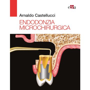 Endodonzia Microchirurgica