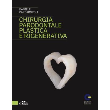 Chirurgia Parodontale Plastica e Rigenerativa