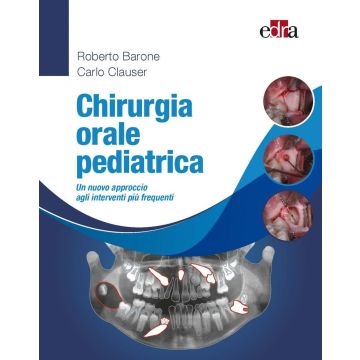 Chirurgia orale pediatrica. Un nuovo approccio agli interventi più frequenti