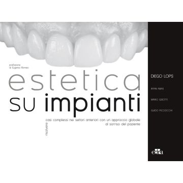 Estetica su impianti. Risolvere casi complessi nei settori anteriori con un approccio globale al sorriso del paziente