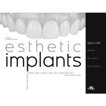 Esthetic implants. How to think about complex cases in anterior areas with a global approach to the patient' s smile