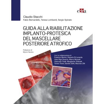 Guida alla riabilitazione implantoprotesica del mascellare posteriore atrofico