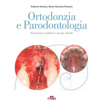 Ortodonzia e parodontologia. Trattamenti combinati e sinergie cliniche [Kaitsas, Paolone - Edra Masson] 
