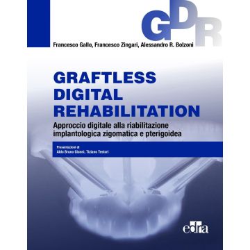 Graftless digital rehabilitatio, GDR. Approccio digitale alla riabilitazione implantologica zigomatica e pterigoidea. Con QR Code