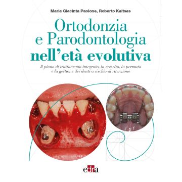 Ortodonzia e parodontologia nell'età evolutiva. Il piano di trattamento integrato, la crescita, la permuta e la gestione dei denti a rischio di ritenzione