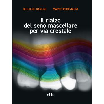 Il rialzo del seno mascellare per via crestale