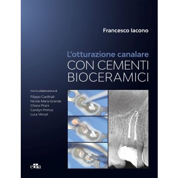 L'otturazione canalare con cementi bioceramici
