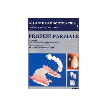 Protesi Parziale