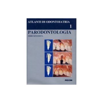 Parodontologia - Atlante