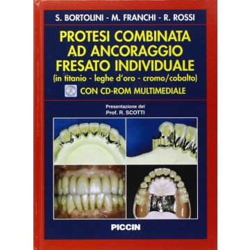 Protesi Combinata ad ancoraggio fresato individuale (in titanio, leghe d'oro, cromo/cobalto) + CD Rom