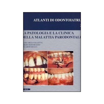 La patologia e la clinica della malattia parodontale