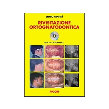 Rivisitazione ortognatodontica + DVD