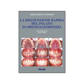 La disgiunzione rapida del palato in ortognatodonzia. Aspetti concettuali ed operatività  clinica