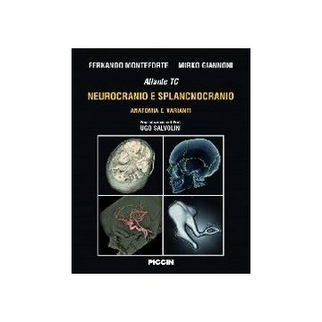 Atlante TC Neurocranio e Splancnocranio - Anatomia e varianti