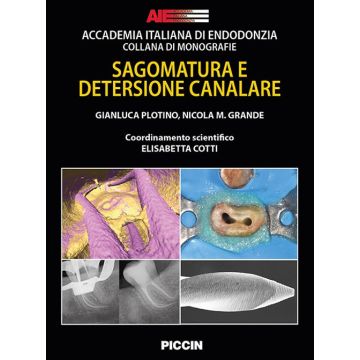 Sagomatura e detersione canalare