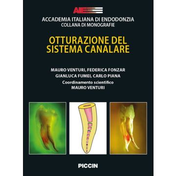 Otturazione del sistema canalare