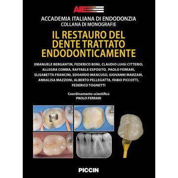 Il restauro del dente trattato endodonticamente
