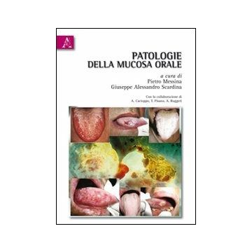 Patologie Della Mucosa Orale