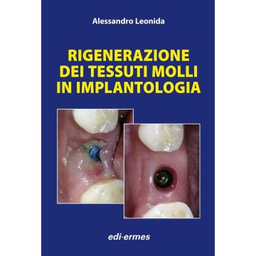Rigenerazione dei tessuti molli in implantologia