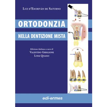 Ortodonzia nella dentizione mista