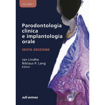 Lindhe - Parodontologia clinica e implantologia orale 6/ed. 