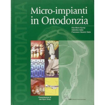 Micro Impianti in Ortodonzia