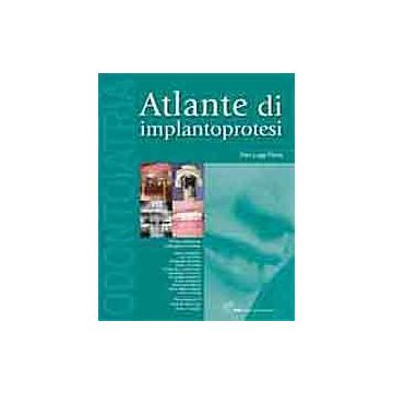 Atlante di Implantoprotesi