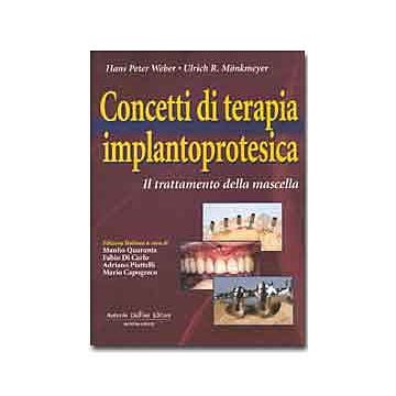 Concetti di Terapia Implantoprotesica