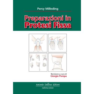 Preparazioni in Protesi Fissa