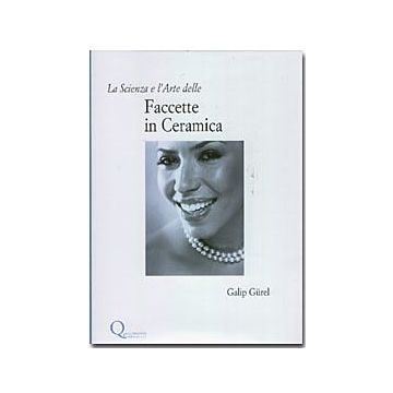 La Scienza e l'Arte delle Faccette in Ceramica