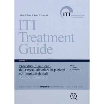ITI Treatment Guide 7 - Procedure di aumento della cresta alveolare in pazienti con impianti dentali - Approccio multifase