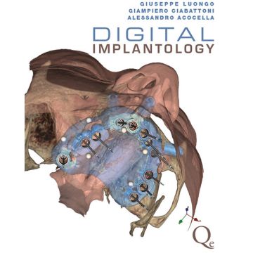 Digital implantology