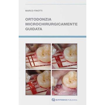 Ortodonzia microchirurgicamente guidata