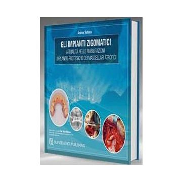 Gli Impianti Zigomatici Attualità nelle riabilitazioni implanto-protesiche dei mascellari atrofici
