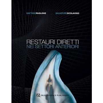Restauri diretti nei settori Anteriori