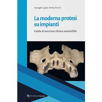 La moderna protesi su impianti. Guida al successo clinico sostenibile