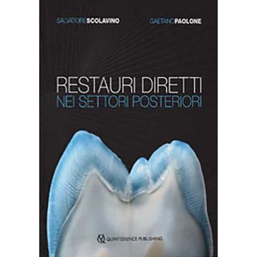 Restauri diretti nei settori posteriori