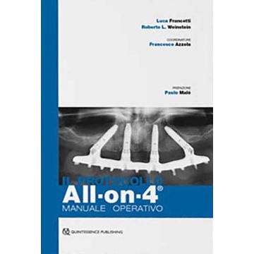 Il protocollo All-on-4®. Manuale operativo