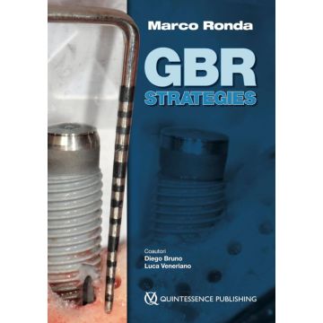 GBR Strategies