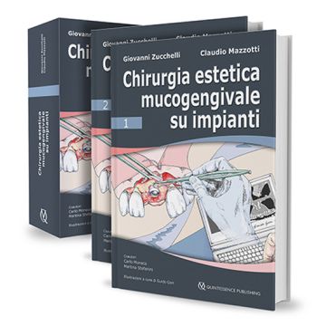 Chirurgia estetica mucogengivale su impianti (2 Voll. con cofanetto)