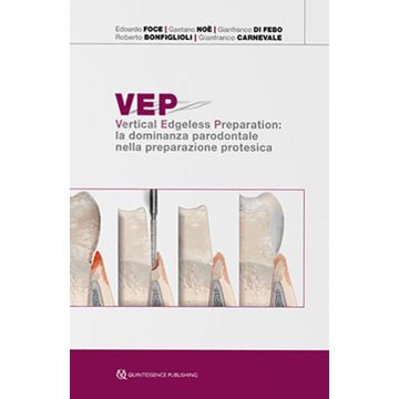VEP  Vertical Edgeless Preparation: la dominanza parodontale nella preparazione protesica 