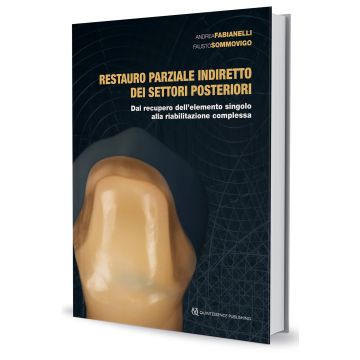 Restauro parziale indiretto dei settori posteriori. Dal recupero dell'elemento singolo alla riabilitazione complessa