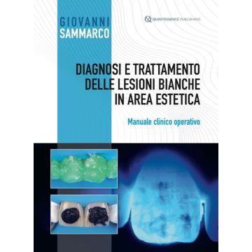 Diagnosi e Trattamento delle Lesioni Bianche in Area Estetica. Manuale clinico operativo