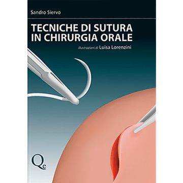 Tecniche di Sutura in Chirurgia Orale