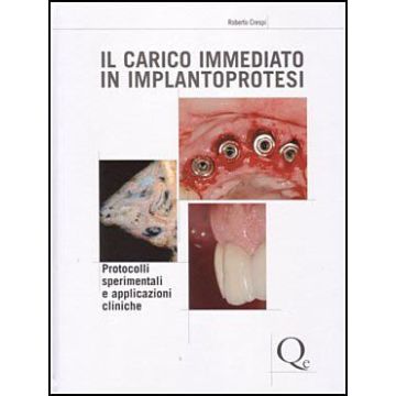 Il Carico Immediato in Implantoprotesi - Protocolli sperimentali e applicazioni cliniche