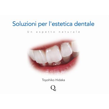 Soluzioni per l'Estetica Dentale - Un aspetto naturale