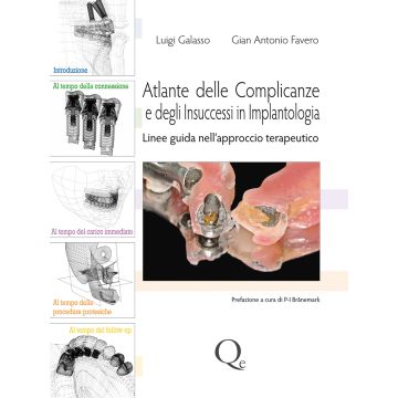 Atlante delle Complicanze e degli Insuccessi in Implantologia. Linee Guida nell'approccio terapeutico