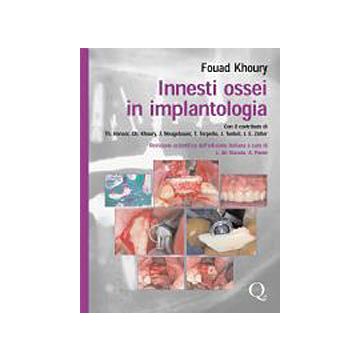 Innesti Ossei in Implantologia
